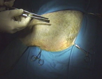 Dr.ペローの 『 整形外科手術テクニック 』　〜 イヌの大腿骨骨折の内固定法 〜