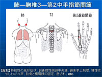 シンクロ矯正法～手足の関節の矯正による上位相対関節の可動性の回復
